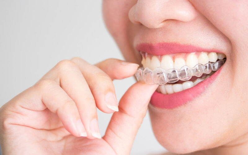 best invisible braces in Hadapsar