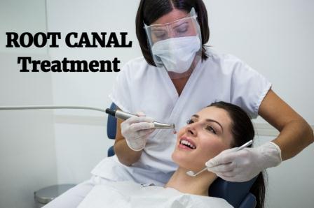 Best Root Canal Treatment in Pune Best Root Canal Treatment in Pune
