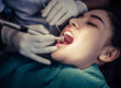 Best Root Canal Treatment in Pune