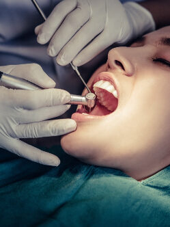 Best Root Canal Treatment in Pune