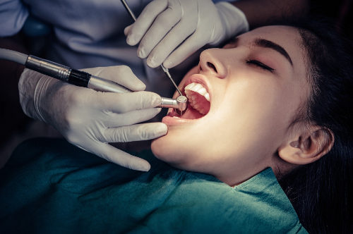 Best Root Canal Treatment in Pune Best Root Canal Treatment in Pune