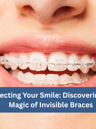 Perfect Smile with Invisible Braces | Dr. Rohini Dental