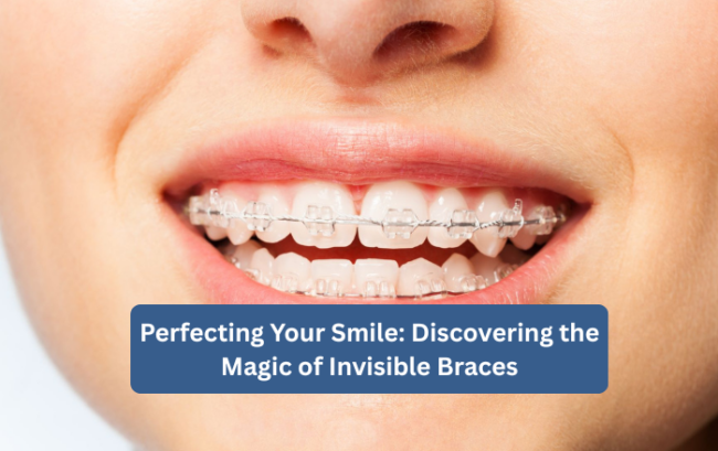 Perfect Smile with Invisible Braces | Dr. Rohini Dental