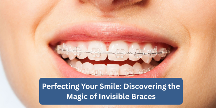 Perfect Smile with Invisible Braces | Dr. Rohini Dental