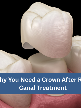 Why You Need a Crown After Root Canal Treatment | Dr. Rohini Lahane