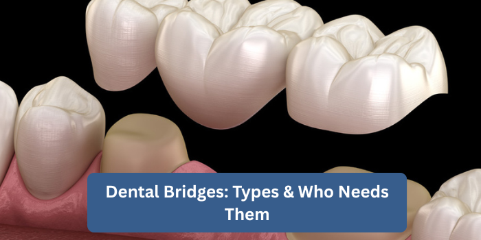 Dental Bridges: Types & Who Needs Them | Restore Your Smile