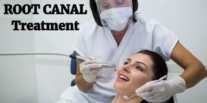 The Do’s and Don’ts of After Root Canal Treatment
